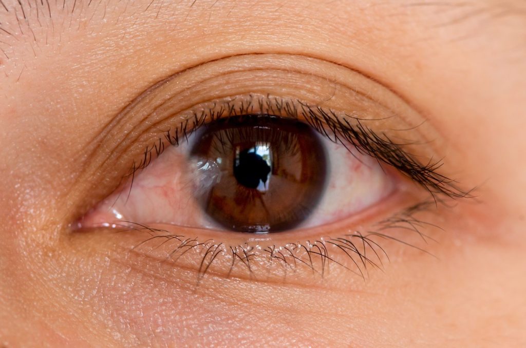 A practical guide to managing pterygium with eyedrops and remedies