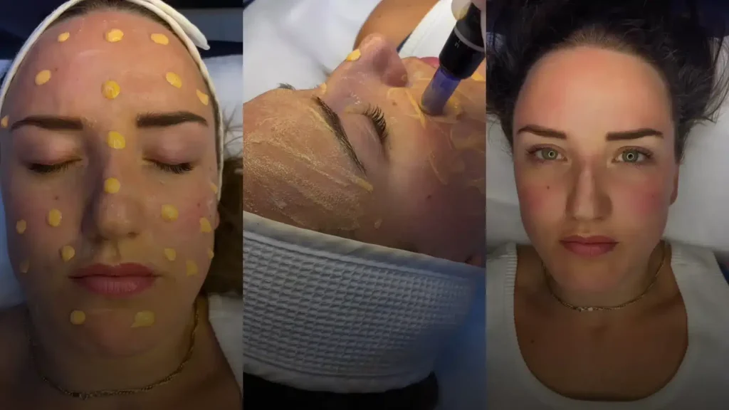 How to Hide Scars with Safe, Natural-Looking Camouflage