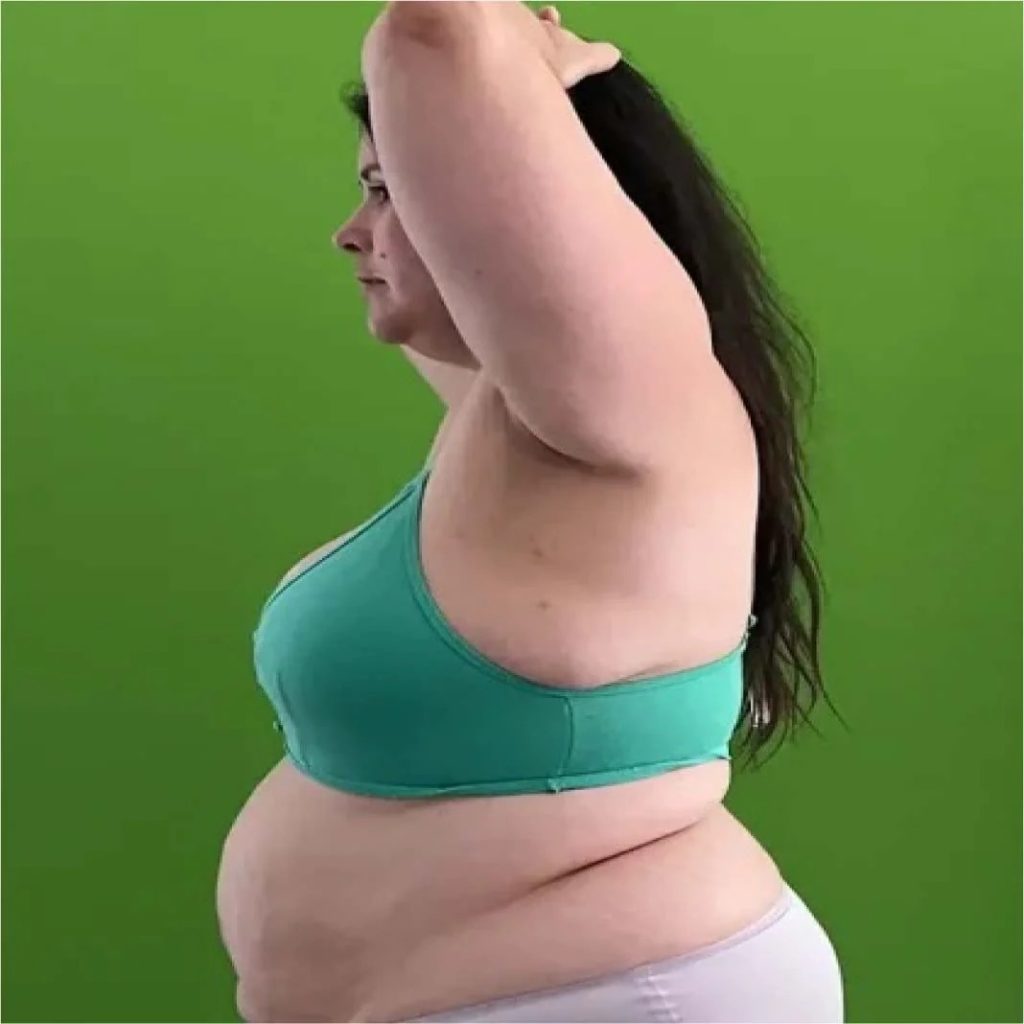 Smart strategies for managing weight with Ozempic the safe way Smart strategies for managing weight with Ozempic the safe way