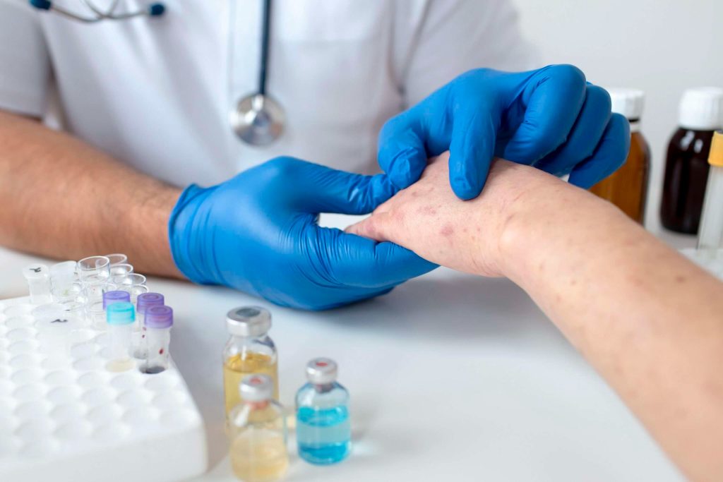 Expert Nail Fungus Care — Find Local Specialists Today Expert Nail Fungus Care — Find Local Specialists Today