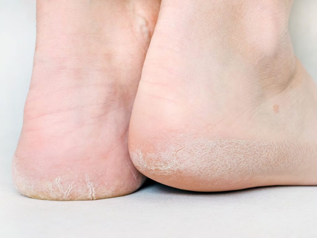 Healing Strategies for Ankle Injuries and Wounds Healing Strategies for Ankle Injuries and Wounds