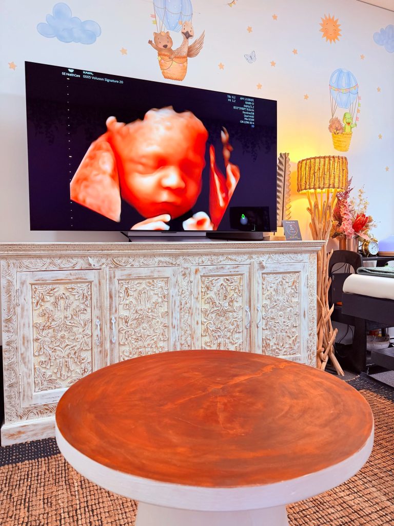 Finding a trusted 4D ultrasound studio near you