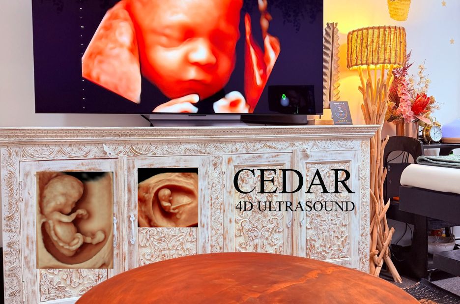 Capturing Baby Moments with Premium 3D/4D Keepsake Imaging Perth Capturing Baby Moments with Premium 3D/4D Keepsake Imaging Perth