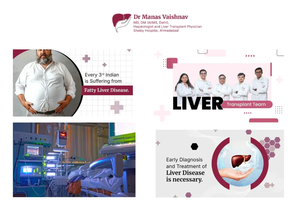 Expert Liver Transplant Surgery in Gujarat | Comprehensive Care at Drmanasvaishnav.com