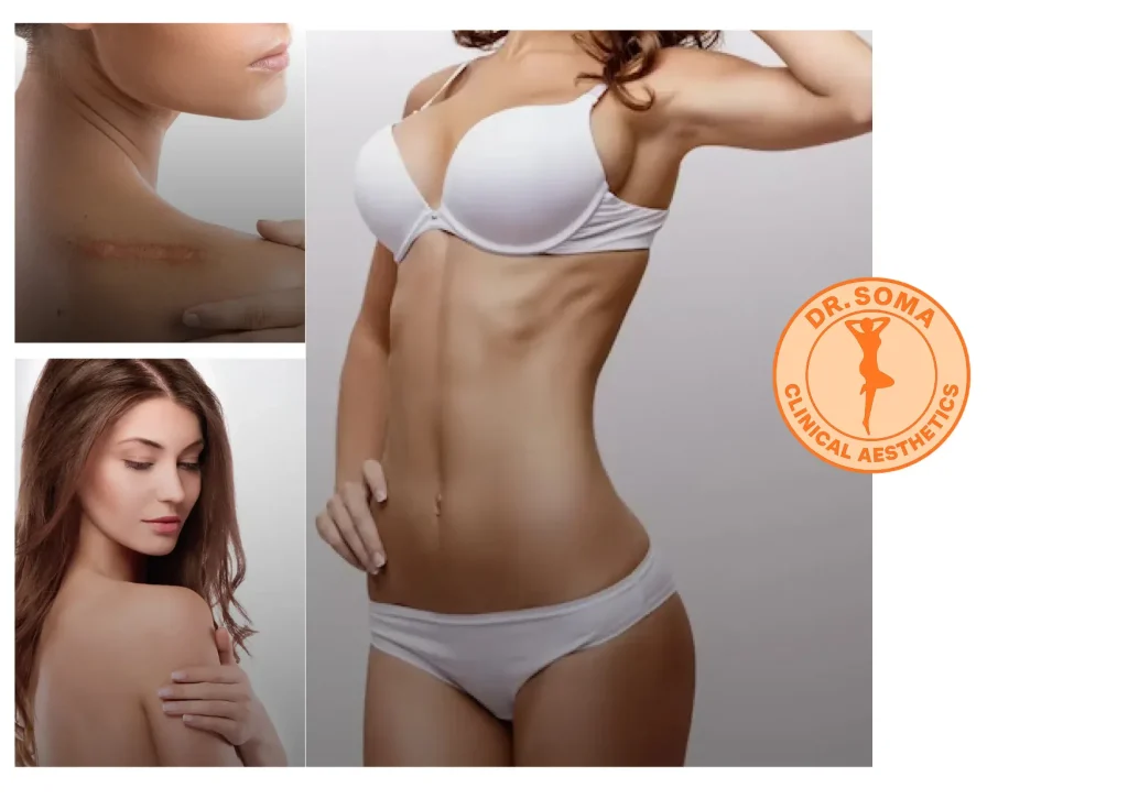 Blepharoplasty Malaysia: Expert Eyelid Surgery for Youthful, Bright Eyes Blepharoplasty Malaysia: Expert Eyelid Surgery for Youthful, Bright Eyes