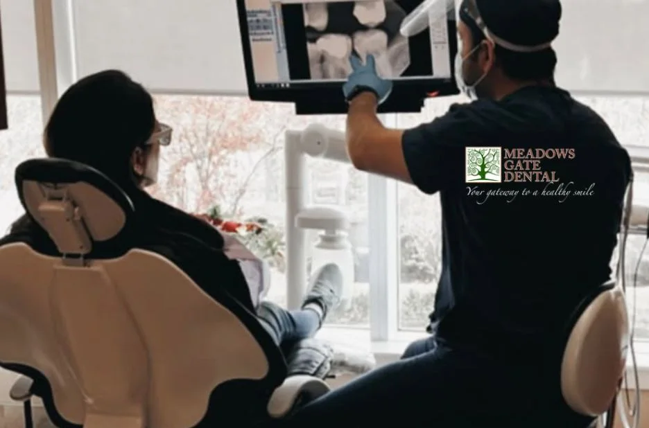 Permanent Teeth Replacement Implant Dentist Pitt Meadows for Lasting Smile Restoration Permanent Teeth Replacement Implant Dentist Pitt Meadows for Lasting Smile Restoration