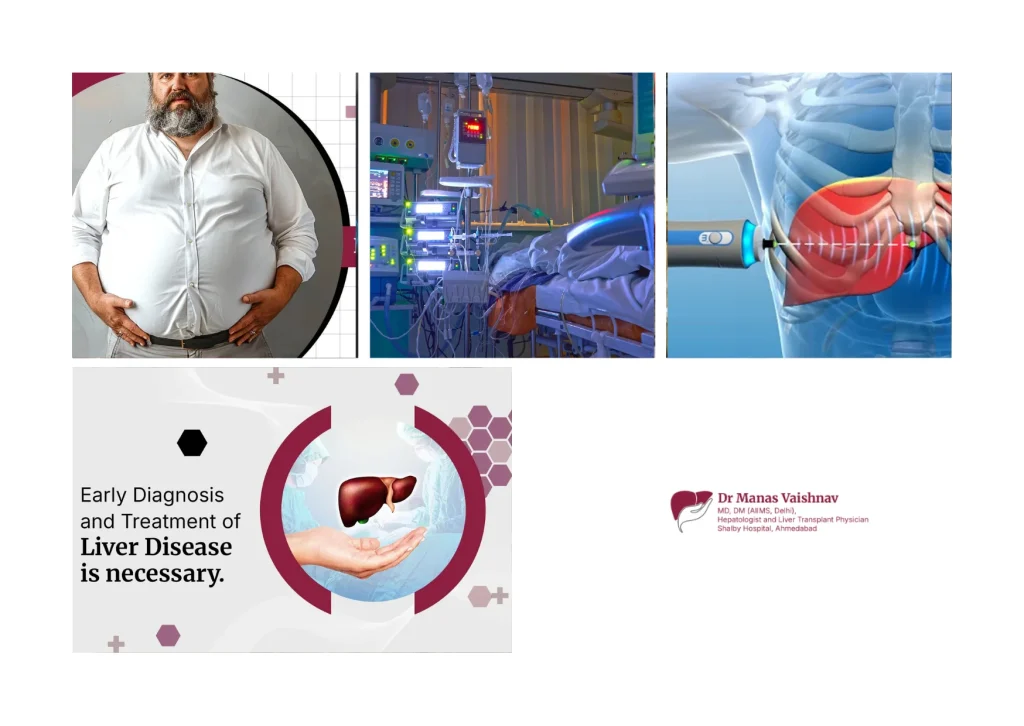 Top Liver Cirrhosis Specialist in Ahmedabad for Advanced Diagnosis and Treatment