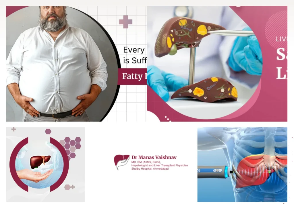 Trusted Liver Specialist in Ahmedabad for Expert Liver and Gastrointestinal Care