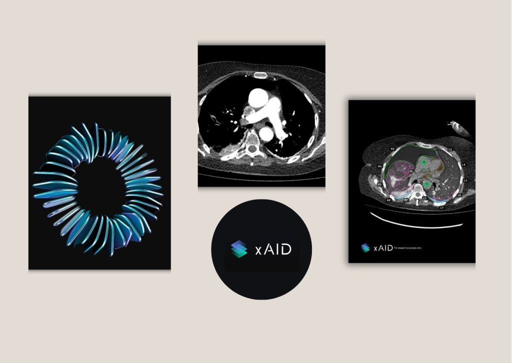 How AI Radiology Vendors Improve Reporting Workflows